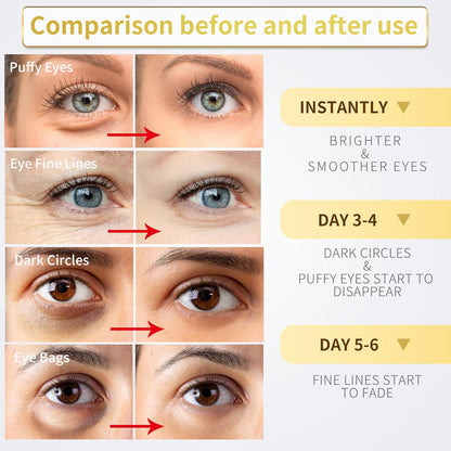 24K gold under eye patches for dark circles, puffiness, and wrinkles care, 60pcs